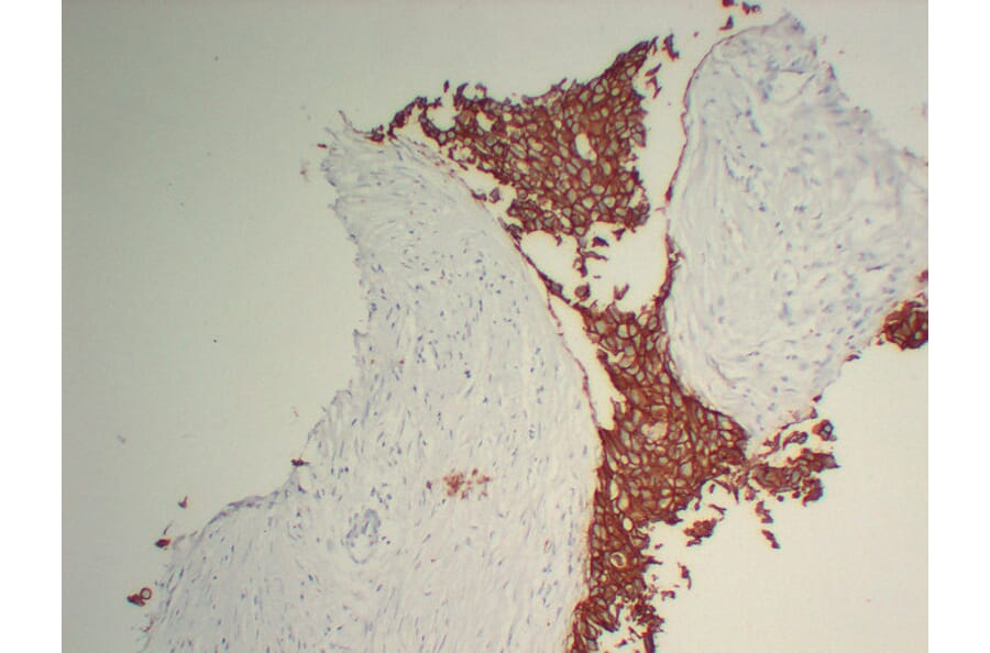 Immunohistochemistry - Anti-Her 2 Antibody (V0083) - Antibodies.com