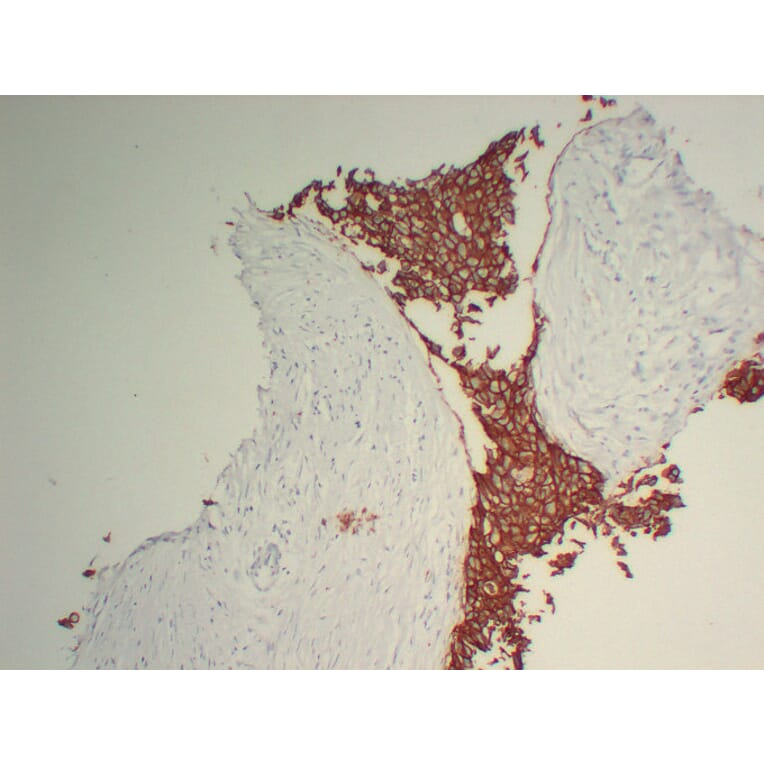 Immunohistochemistry - Anti-Her 2 Antibody (V0083) - Antibodies.com