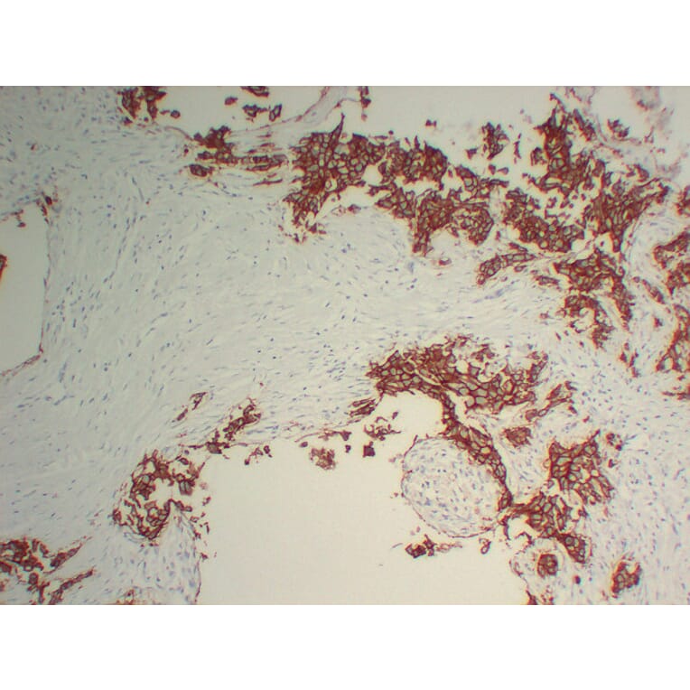 Immunohistochemistry - Anti-Her 2 Antibody (V0083) - Antibodies.com