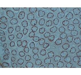 Immunohistochemistry - Anti-CDX 2 Antibody (V0040) - Antibodies.com