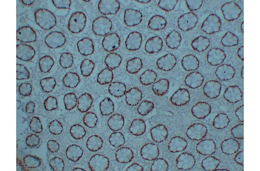 Immunohistochemistry - Anti-CDX 2 Antibody (V0040) - Antibodies.com