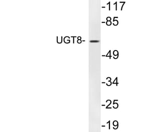 Western Blot - Anti-UGT8 Antibody (R12-2402) - Antibodies.com