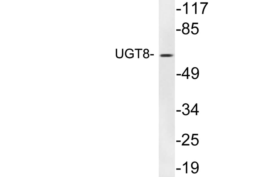 Western Blot - Anti-UGT8 Antibody (R12-2402) - Antibodies.com