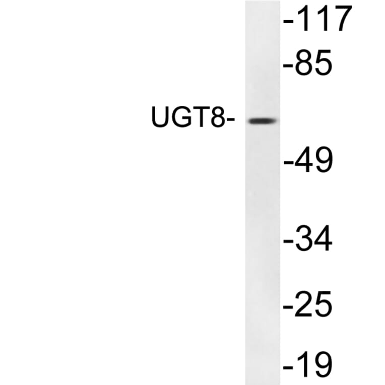 Western Blot - Anti-UGT8 Antibody (R12-2402) - Antibodies.com