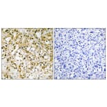 Immunohistochemistry - Anti-TFAM Antibody (C10817) - Antibodies.com