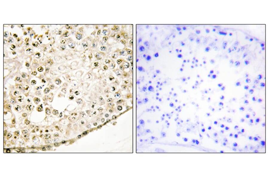 Immunohistochemistry - Anti-SPZ1 Antibody (C11631) - Antibodies.com