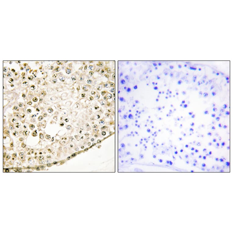 Immunohistochemistry - Anti-SPZ1 Antibody (C11631) - Antibodies.com