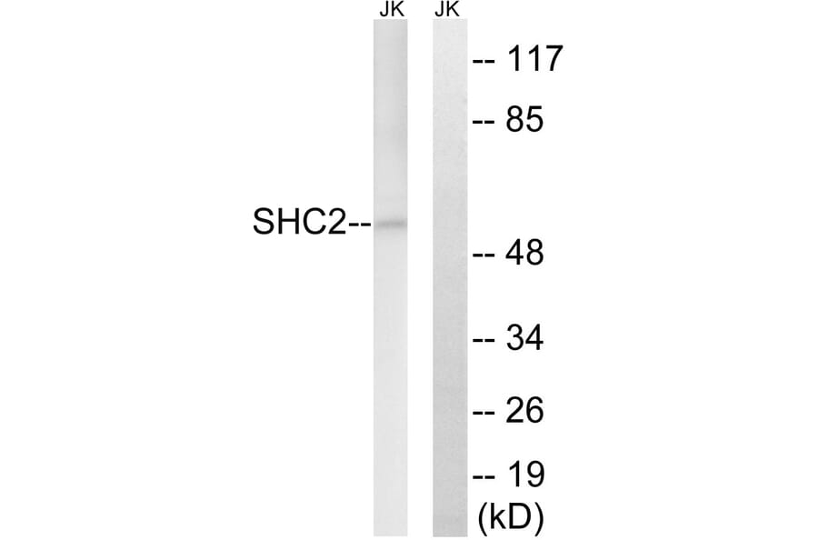 Western Blot - Anti-SHC2 Antibody (C18733) - Antibodies.com