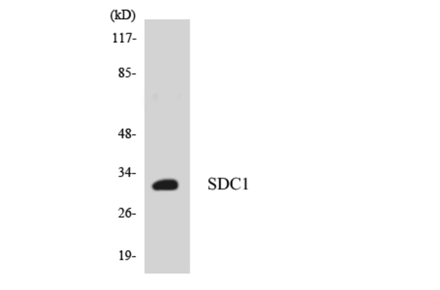 Western Blot - Anti-SDC1 Antibody (R12-3486) - Antibodies.com