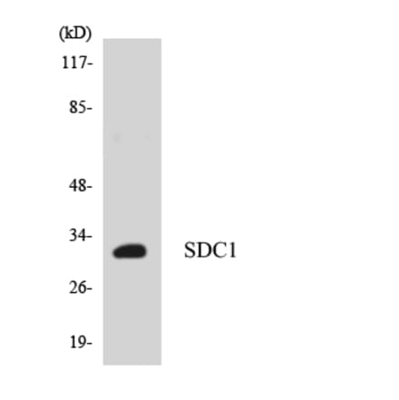 Western Blot - Anti-SDC1 Antibody (R12-3486) - Antibodies.com