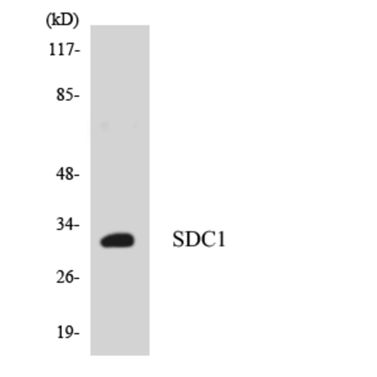 Western Blot - Anti-SDC1 Antibody (R12-3486) - Antibodies.com