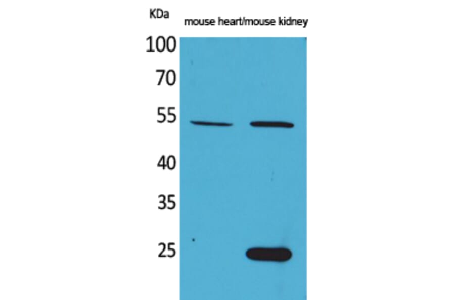 Western Blot - Anti-SCG3 Antibody (C30009) - Antibodies.com