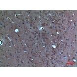 Immunohistochemistry - Anti-SCG3 Antibody (C30009) - Antibodies.com