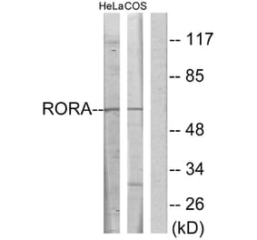 Western Blot - Anti-RORA Antibody (C10554) - Antibodies.com