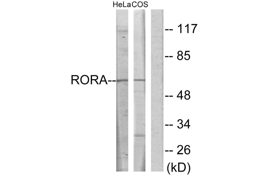 Western Blot - Anti-RORA Antibody (C10554) - Antibodies.com