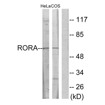 Western Blot - Anti-RORA Antibody (C10554) - Antibodies.com