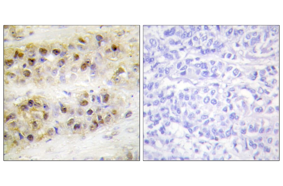 Immunohistochemistry - Anti-RORA Antibody (C10554) - Antibodies.com