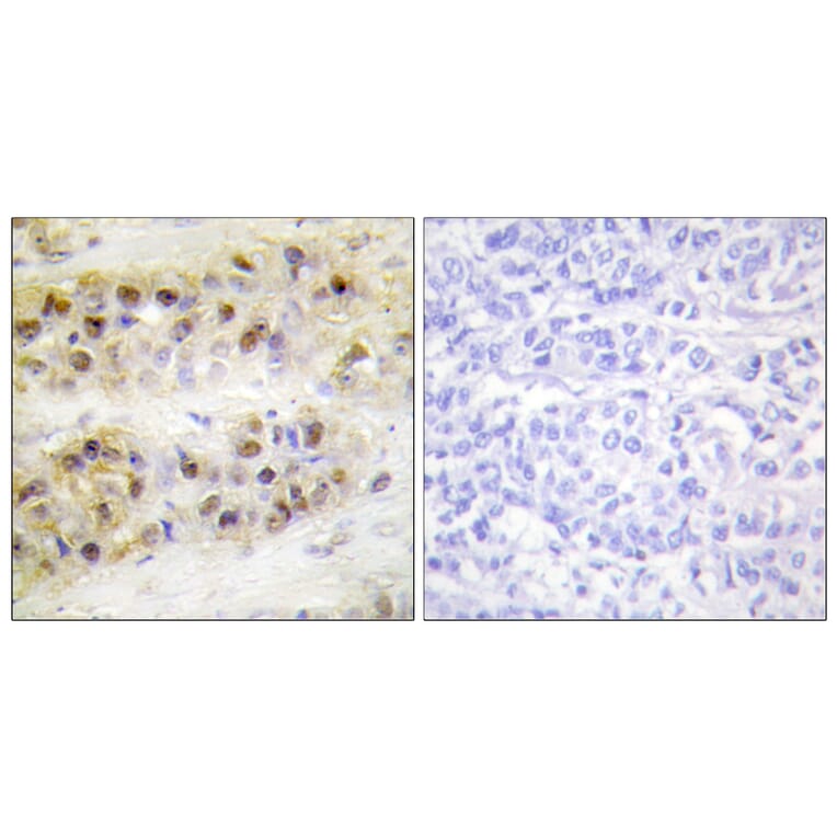 Immunohistochemistry - Anti-RORA Antibody (C10554) - Antibodies.com