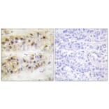Immunohistochemistry - Anti-RORA Antibody (C10554) - Antibodies.com