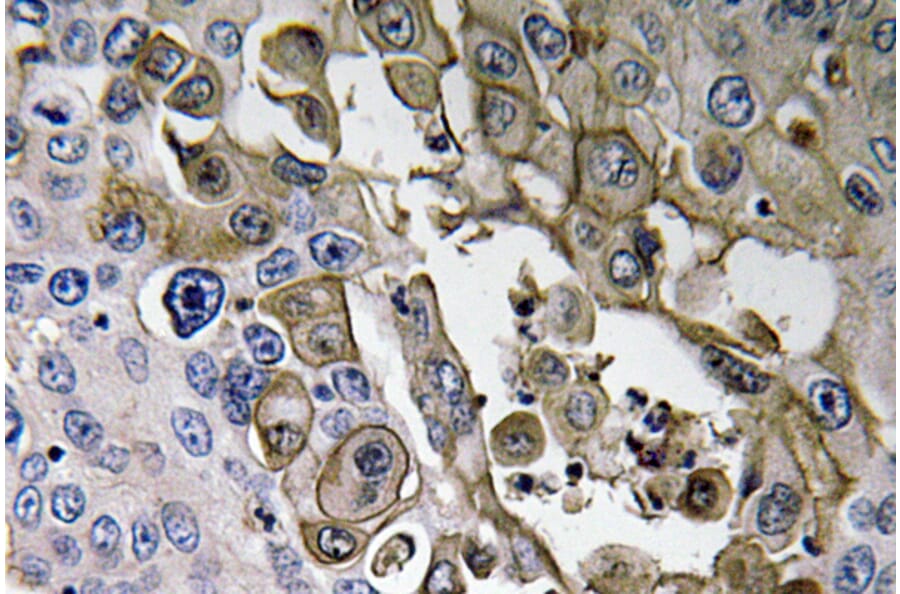 Immunohistochemistry - Anti-RAGE Antibody (R12-2327) - Antibodies.com