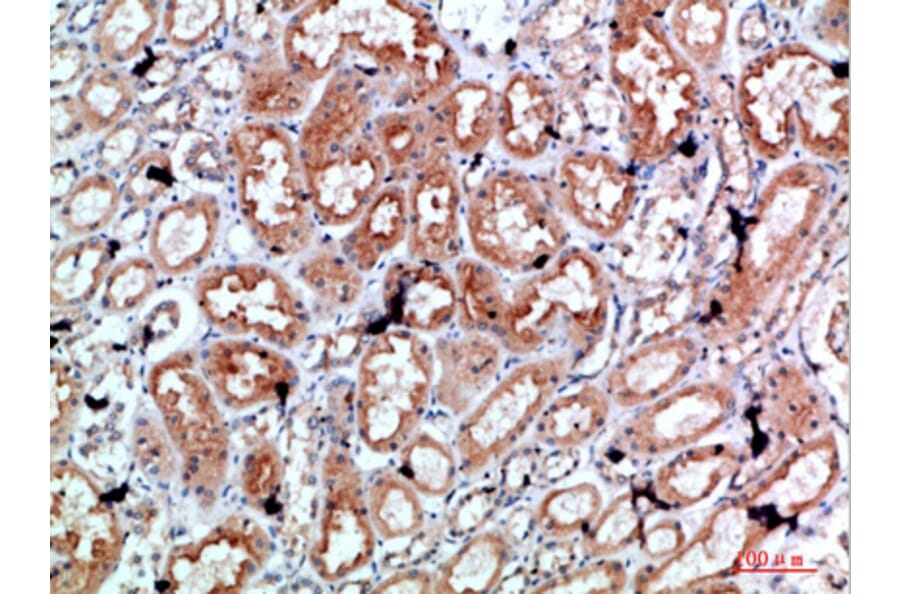 Immunohistochemistry - Anti-PRF1 Antibody (C30848) - Antibodies.com