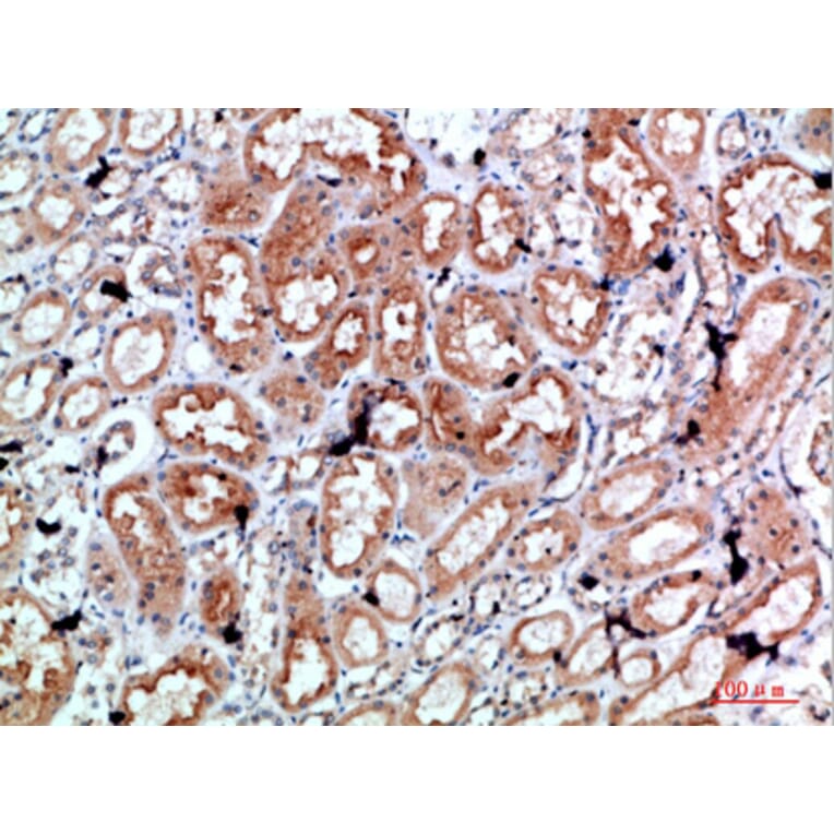 Immunohistochemistry - Anti-PRF1 Antibody (C30848) - Antibodies.com