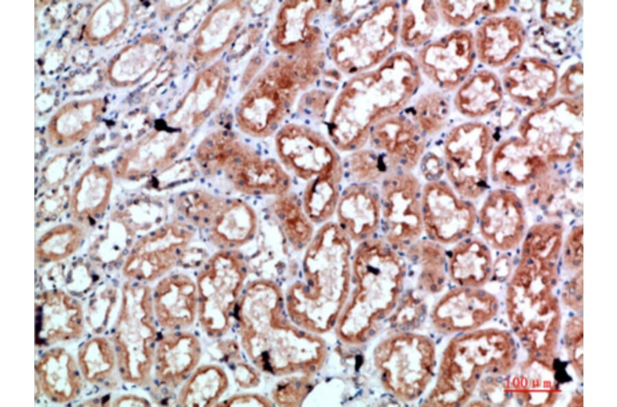 Immunohistochemistry - Anti-PRF1 Antibody (C30848) - Antibodies.com