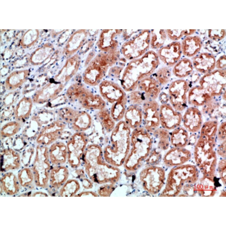 Immunohistochemistry - Anti-PRF1 Antibody (C30848) - Antibodies.com