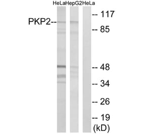 Western Blot - Anti-PKP2 Antibody (C17732) - Antibodies.com