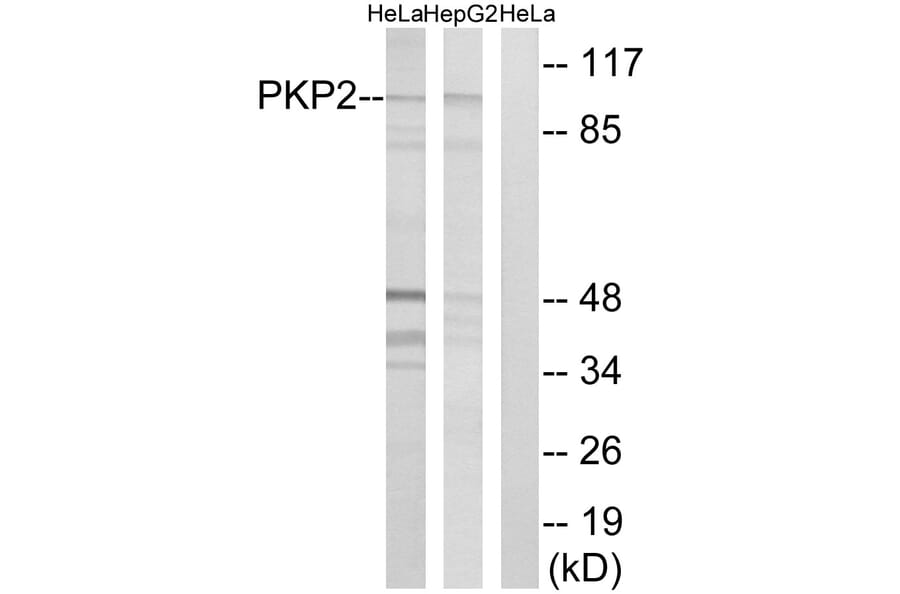 Western Blot - Anti-PKP2 Antibody (C17732) - Antibodies.com