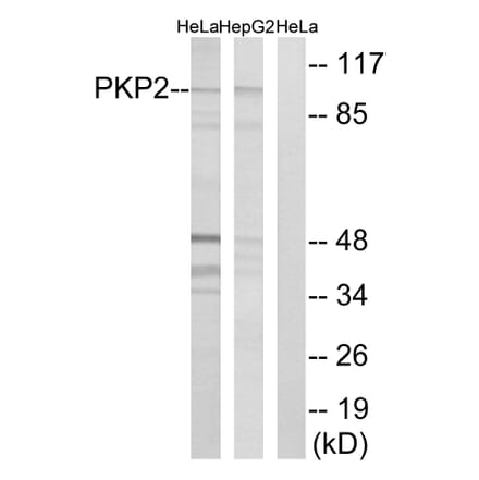 Western Blot - Anti-PKP2 Antibody (C17732) - Antibodies.com