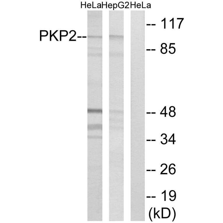 Western Blot - Anti-PKP2 Antibody (C17732) - Antibodies.com