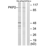 Western Blot - Anti-PKP2 Antibody (C17732) - Antibodies.com