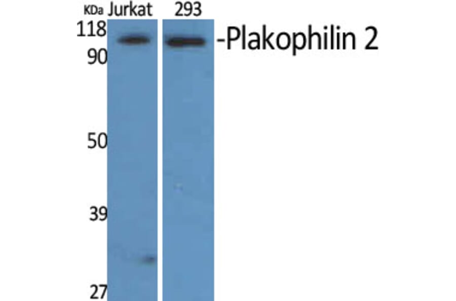 Western Blot - Anti-PKP2 Antibody (C17732) - Antibodies.com