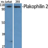 Western Blot - Anti-PKP2 Antibody (C17732) - Antibodies.com