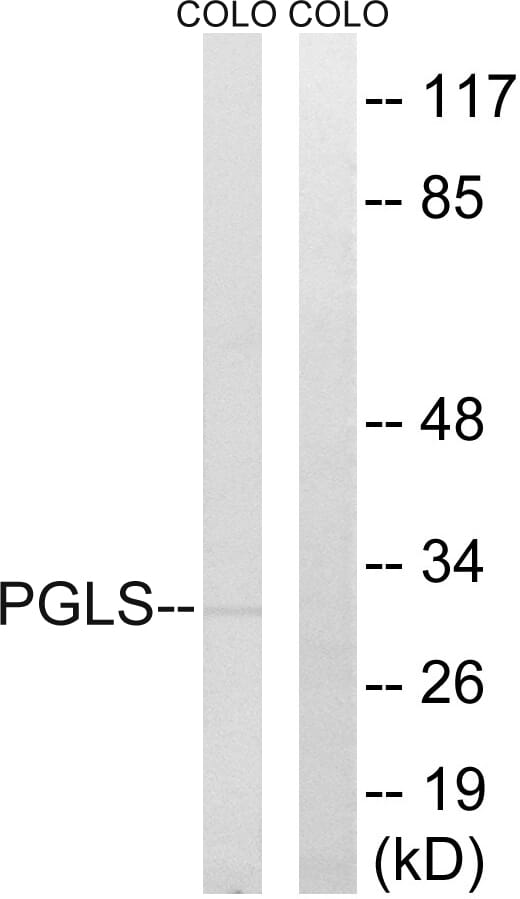 Western blot analysis of lysates from COLO cells using Anti-PGLS Antibody. The right hand lane represents a negative control, where the antibody is blocked by the immunising peptide.