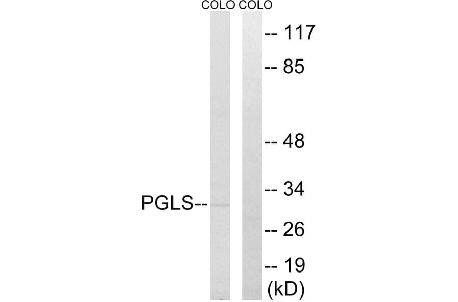 Western Blot - Anti-PGLS Antibody (C14200) - Antibodies.com