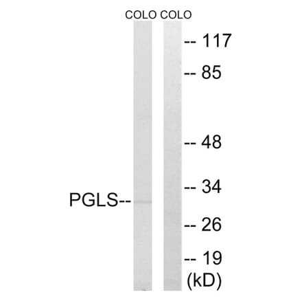 Western Blot - Anti-PGLS Antibody (C14200) - Antibodies.com