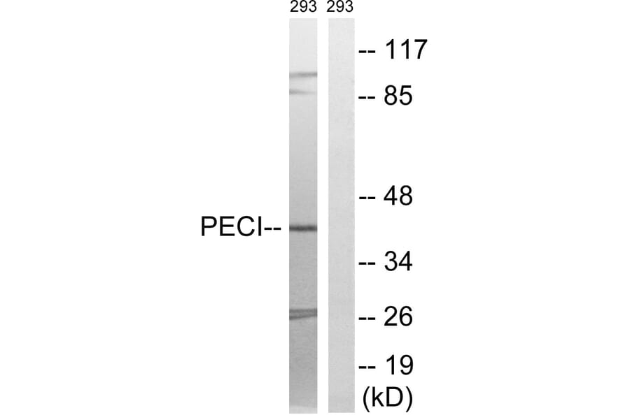 Western Blot - Anti-PECI Antibody (C17621) - Antibodies.com