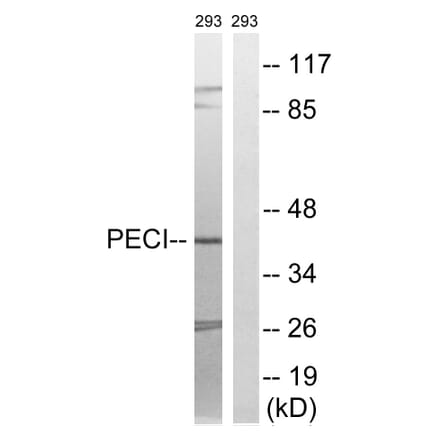 Western Blot - Anti-PECI Antibody (C17621) - Antibodies.com