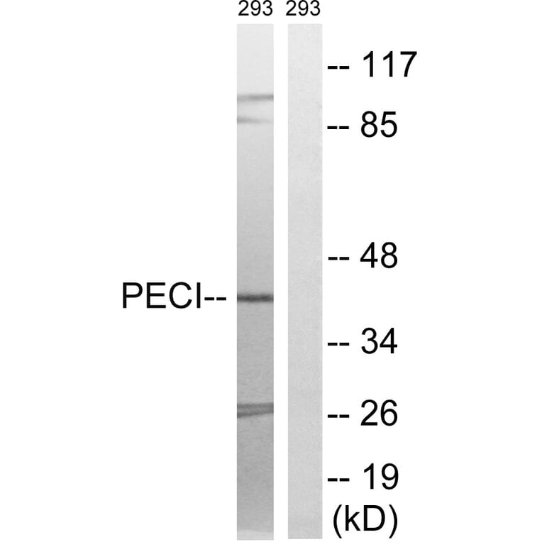 Western Blot - Anti-PECI Antibody (C17621) - Antibodies.com