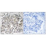 Immunohistochemistry - Anti-PECI Antibody (C17621) - Antibodies.com