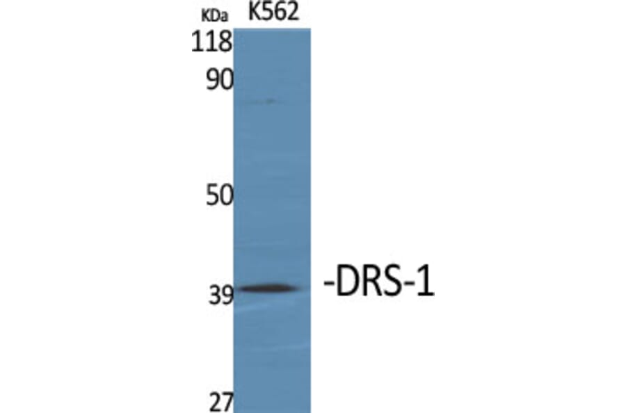 Western Blot - Anti-PECI Antibody (C17621) - Antibodies.com