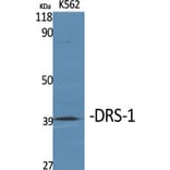 Western Blot - Anti-PECI Antibody (C17621) - Antibodies.com