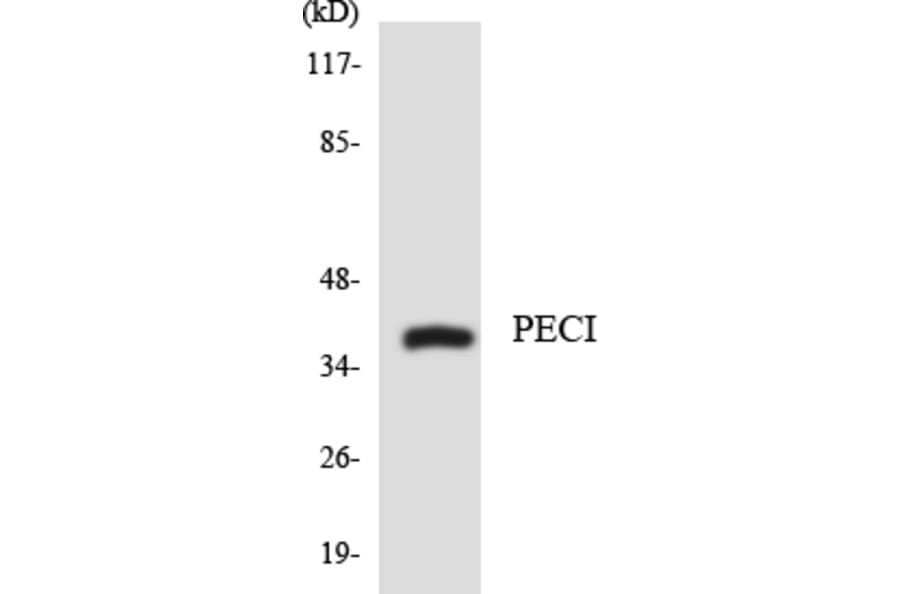 Western Blot - Anti-PECI Antibody (R12-3316) - Antibodies.com