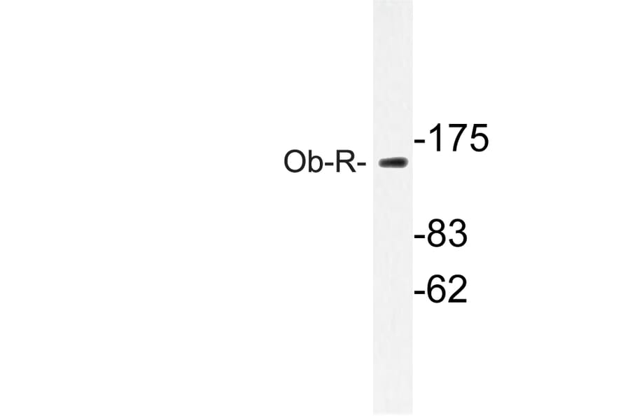 Western Blot - Anti-Ob-R Antibody (R12-2280) - Antibodies.com