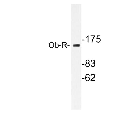 Western Blot - Anti-Ob-R Antibody (R12-2280) - Antibodies.com