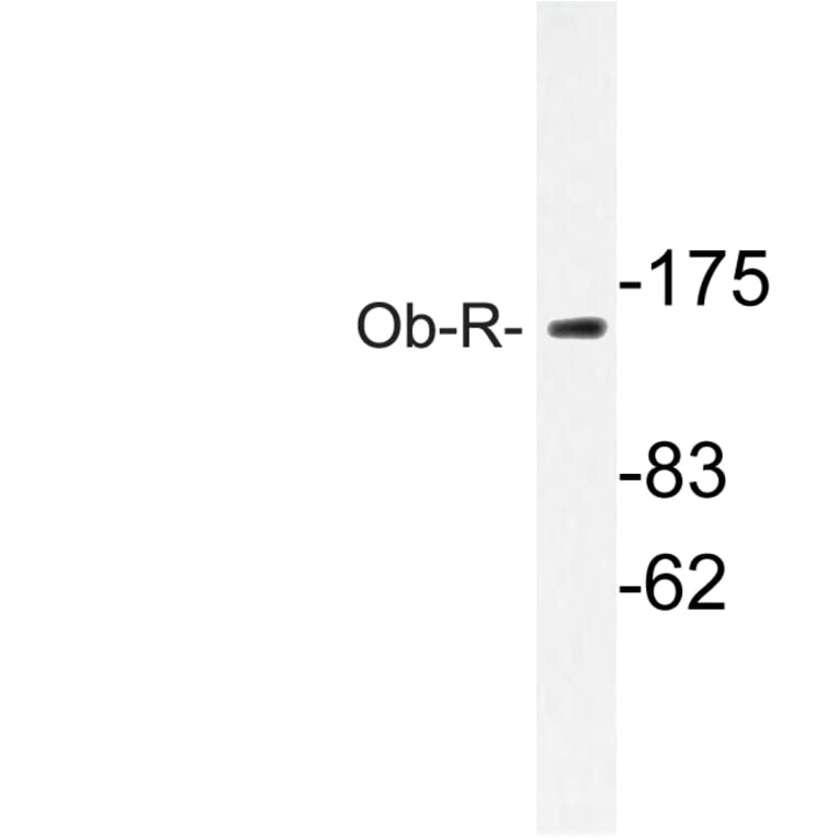 Western Blot - Anti-Ob-R Antibody (R12-2280) - Antibodies.com