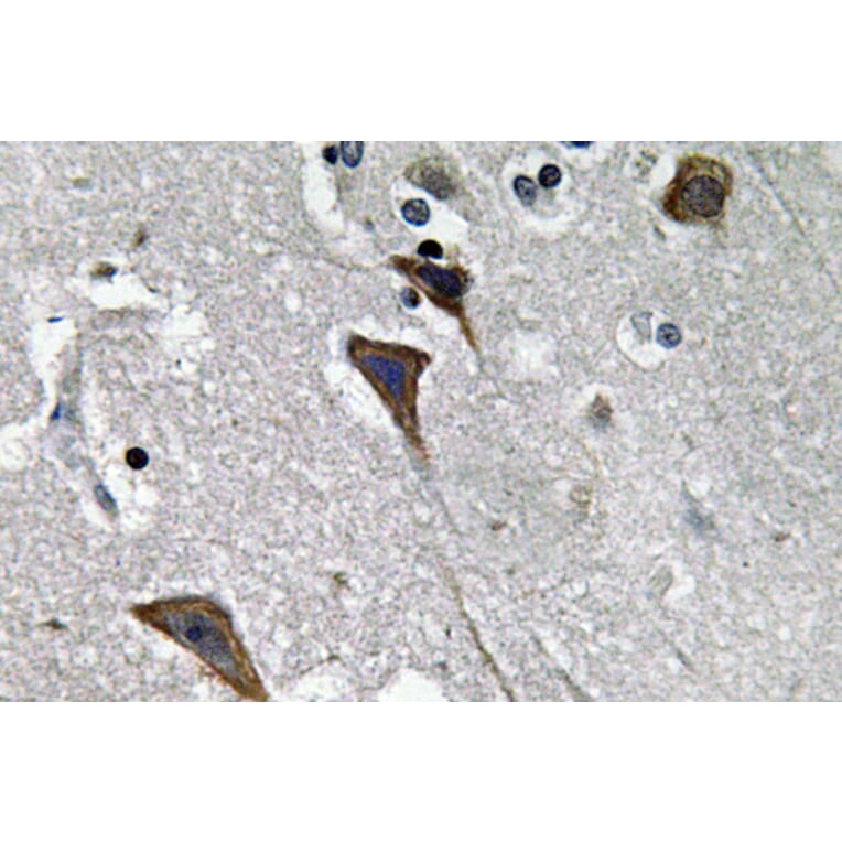 Immunohistochemistry - Anti-Ob-R Antibody (R12-2280) - Antibodies.com