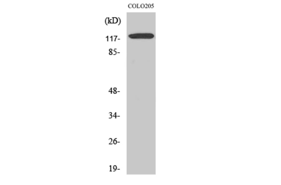 Western Blot - Anti-Ob-R Antibody (R12-2280) - Antibodies.com
